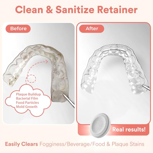 Weiss Naturals Retainer Cleaner Tablets, Invisalign Cleaner, Remove Stains, Odors & Plaque, FSA & HSA Eligible, Night Guard Cleaners PERSULFATE & DYE-FREE 4-Month Supply, Denture Cleaners 120 Tablets