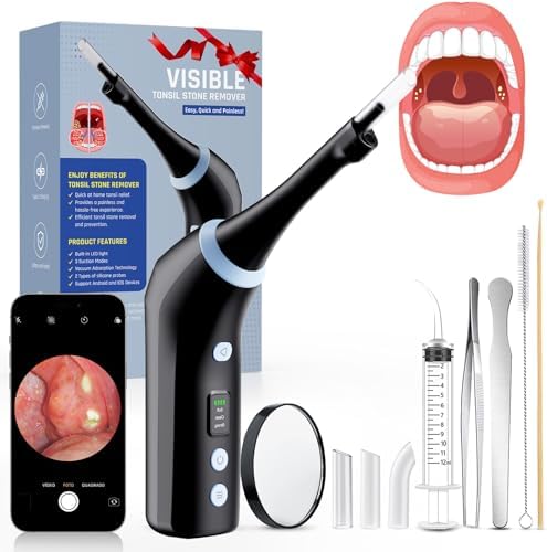 Electronic Tonsil Stone Remover with Camera, Tonsil Stone Removal Kit, 3 Suction Levels, Tonsil Stone Vacuum, Oral Care for Mouth Health, USB Rechargeable (Black)